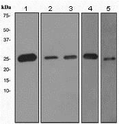 Western blot - Anti-PGP9.5 antibody [EPR4118] - Neuronal Marker (ab108986), expandable thumbnail