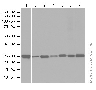 Western blot - Anti-PGP9.5 antibody [EPR4118] - Neuronal Marker (ab108986), expandable thumbnail