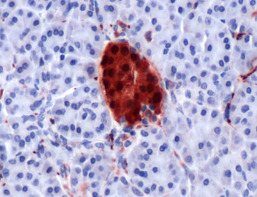 Immunohistochemistry (Formalin/PFA-fixed paraffin-embedded sections) - Anti-PGP9.5 antibody - Neuronal Marker (AB15503), expandable thumbnail