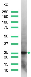 Western blot - Anti-PGP9.5 antibody - Neuronal Marker (AB15503), expandable thumbnail