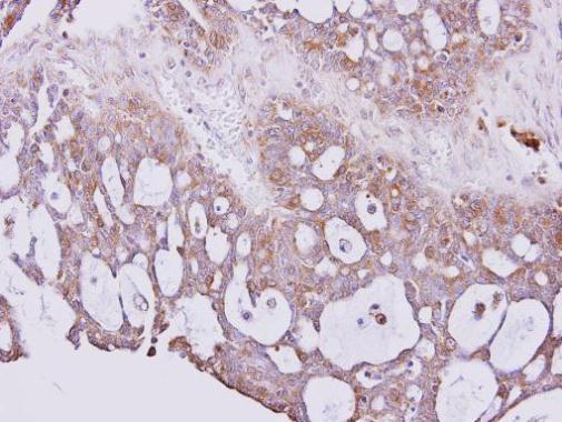 Immunohistochemistry (Formalin/PFA-fixed paraffin-embedded sections) - Anti-PGP9.5 antibody - Neuronal Marker (AB227157), expandable thumbnail