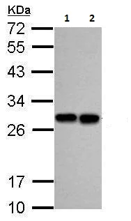 Western blot - Anti-PGP9.5 antibody - Neuronal Marker (AB227157)