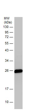 Western blot - Anti-PGP9.5 antibody - Neuronal Marker (AB227157), expandable thumbnail