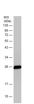 Western blot - Anti-PGP9.5 antibody - Neuronal Marker (AB227157)