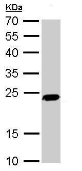 Western blot - Anti-PGP9.5 antibody - Neuronal Marker (ab227157), expandable thumbnail