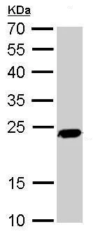 Western blot - Anti-PGP9.5 antibody - Neuronal Marker (AB227157)