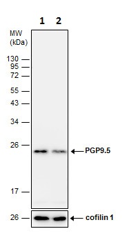 Western blot - Anti-PGP9.5 antibody - Neuronal Marker (AB227157), expandable thumbnail