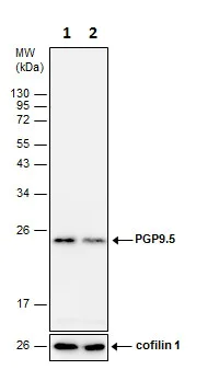Western blot - Anti-PGP9.5 antibody - Neuronal Marker (AB227157)