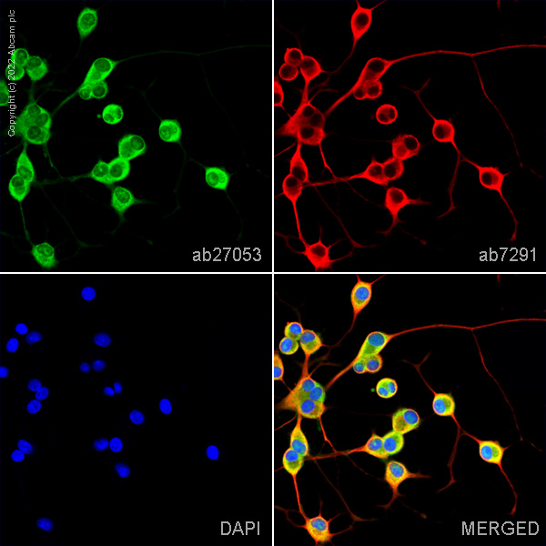 Anti-PGP9.5 antibody - Neuronal Marker