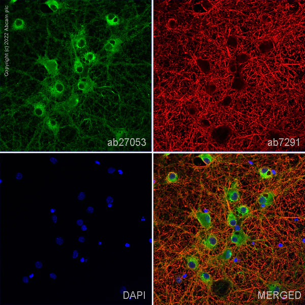 Immunocytochemistry/ Immunofluorescence - Anti-PGP9.5 antibody - Neuronal Marker (AB27053)