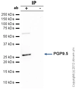Immunoprecipitation - Anti-PGP9.5 antibody - Neuronal Marker (AB27053)