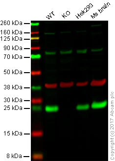 Western blot - Anti-PGP9.5 antibody - Neuronal Marker (AB27053)