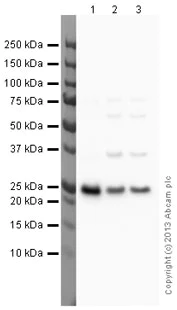 Western blot - Anti-PGP9.5 antibody - Neuronal Marker (AB27053)
