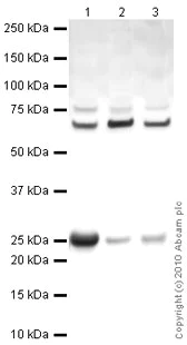 Western blot - Anti-PGP9.5 antibody - Neuronal Marker (AB27053)