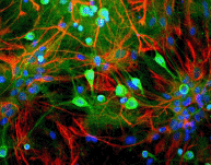 Immunocytochemistry/ Immunofluorescence - Anti-PGP9.5 antibody - Neuronal Marker (AB72910), expandable thumbnail