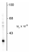 Western blot - Anti-PGP9.5 antibody - Neuronal Marker (AB72910), expandable thumbnail
