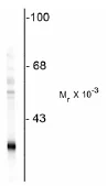 Western blot - Anti-PGP9.5 antibody - Neuronal Marker (AB72910)