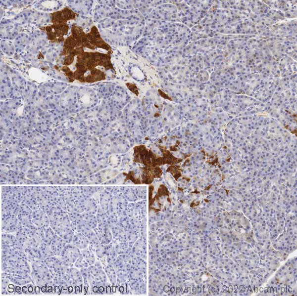 Immunohistochemistry (Formalin/PFA-fixed paraffin-embedded sections) - Anti-PGP9.5 antibody, prediluted (AB15504)