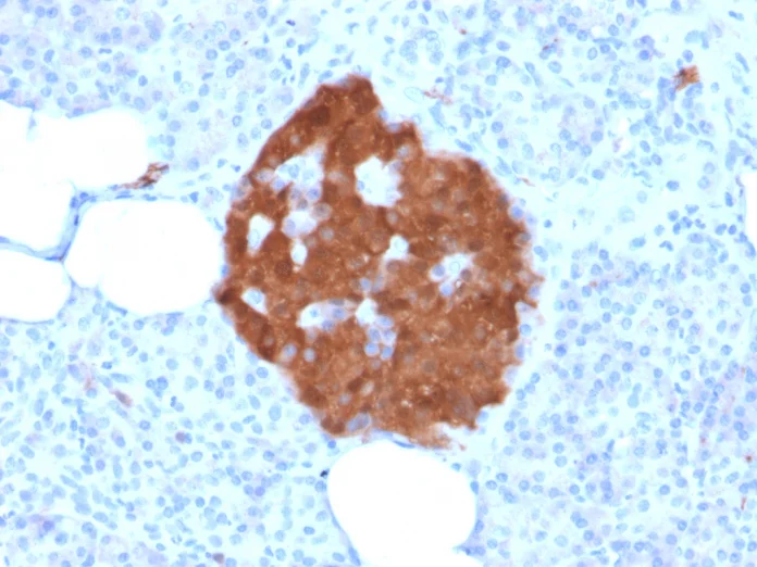 Immunohistochemistry (Formalin/PFA-fixed paraffin-embedded sections) - Anti-PGP9.5 antibody [rUCHL1/775] (AB238074)