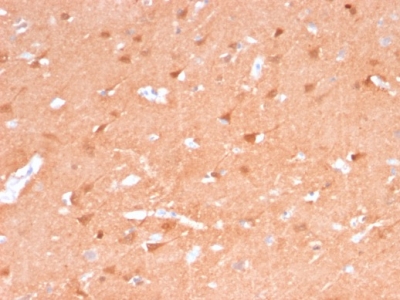 Immunohistochemistry (Formalin/PFA-fixed paraffin-embedded sections) - Anti-PGP9.5 antibody [rUCHL1/775] (AB238074)