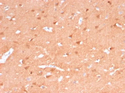 Immunohistochemistry (Formalin/PFA-fixed paraffin-embedded sections) - Anti-PGP9.5 antibody [rUCHL1/775] (AB238074)