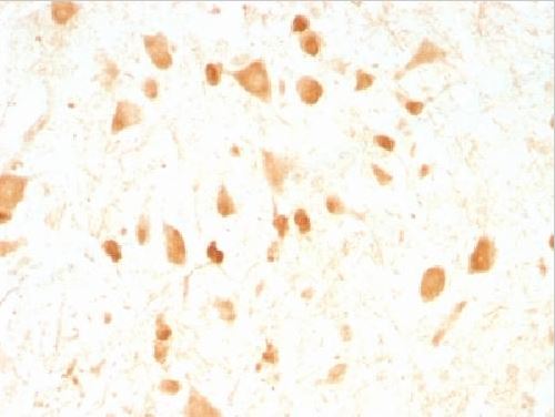 Immunohistochemistry (Formalin/PFA-fixed paraffin-embedded sections) - Anti-PGP9.5 antibody [UCHL1/775] (AB220209), expandable thumbnail