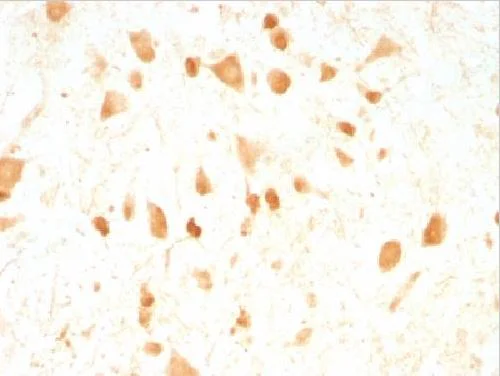 Immunohistochemistry (Formalin/PFA-fixed paraffin-embedded sections) - Anti-PGP9.5 antibody [UCHL1/775] - Neuronal Marker (AB220209)