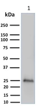 Western blot - Anti-PGP9.5 antibody [UCHL1/775] - Neuronal Marker (AB220209), expandable thumbnail