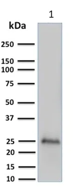 Western blot - Anti-PGP9.5 antibody [UCHL1/775] - Neuronal Marker (AB220209)