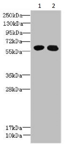 Western blot - Anti-PGPL antibody (AB235771), expandable thumbnail