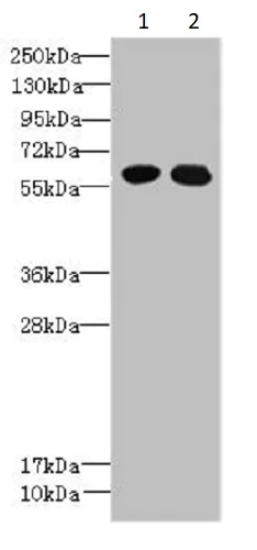 Western blot - Anti-PGPL antibody (AB235771)