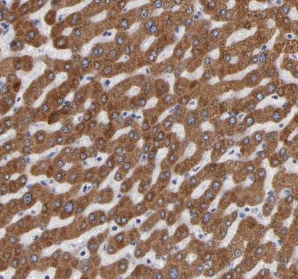Immunohistochemistry (Formalin/PFA-fixed paraffin-embedded sections) - Anti-PGRMC1 antibody (AB224054)