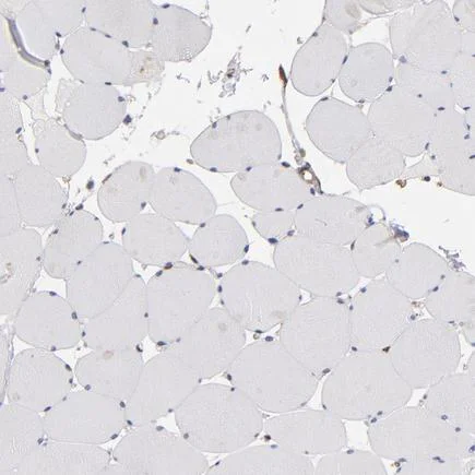 Immunohistochemistry (Formalin/PFA-fixed paraffin-embedded sections) - Anti-PGRMC1 antibody (AB224054)