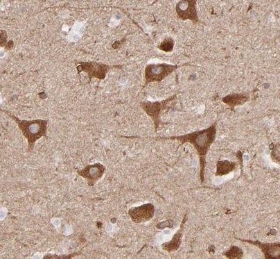 Immunohistochemistry (Formalin/PFA-fixed paraffin-embedded sections) - Anti-PGRMC1 antibody (AB224054)
