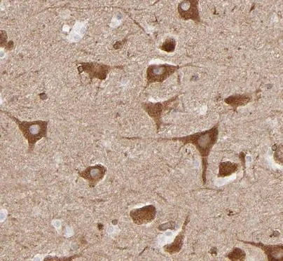Immunohistochemistry (Formalin/PFA-fixed paraffin-embedded sections) - Anti-PGRMC1 antibody (AB224054)