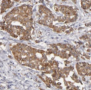Immunohistochemistry (Formalin/PFA-fixed paraffin-embedded sections) - Anti-PGRMC1 antibody (AB224054)