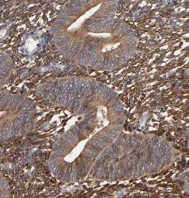 Immunohistochemistry (Formalin/PFA-fixed paraffin-embedded sections) - Anti-PGRMC1 antibody (AB224054)