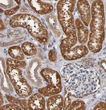 Immunohistochemistry (Formalin/PFA-fixed paraffin-embedded sections) - Anti-PGRMC1 antibody (AB224054)