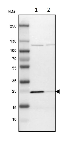Western blot - Anti-PGRMC1 antibody (AB224054)
