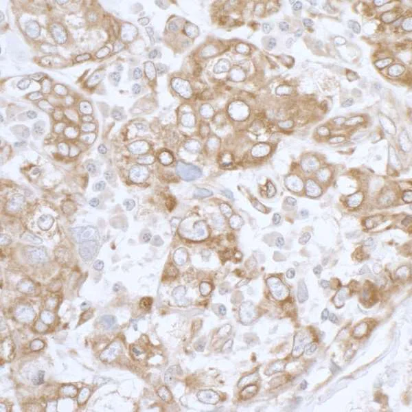 Immunohistochemistry (Formalin/PFA-fixed paraffin-embedded sections) - Anti-PGRMC1 antibody - C-terminal (AB194879)