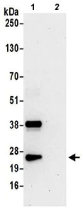 Immunoprecipitation - Anti-PGRMC1 antibody - C-terminal (AB194879)