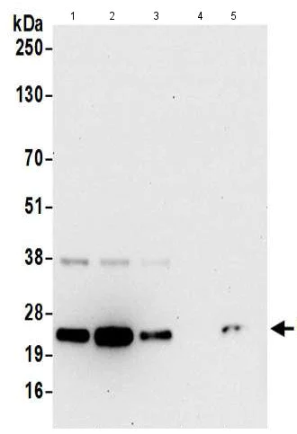 Western blot - Anti-PGRMC1 antibody - C-terminal (AB194879)