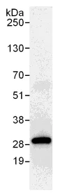 Immunoprecipitation - Anti-PGRMC2 antibody (AB104437)