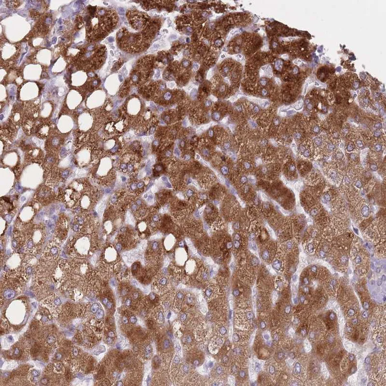 Immunohistochemistry (Formalin/PFA-fixed paraffin-embedded sections) - Anti-PGRMC2 antibody (AB251875)