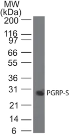 Western blot - Anti-PGRPS antibody [188C424] (AB13903)