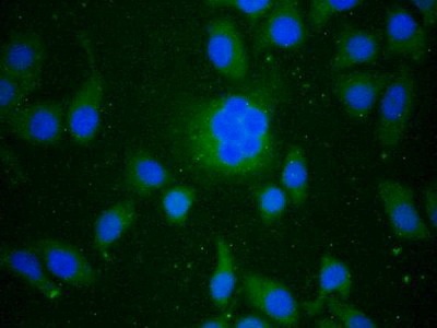 Immunocytochemistry/ Immunofluorescence - Anti-PGRPS antibody (AB232728)