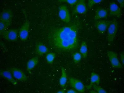 Immunocytochemistry/ Immunofluorescence - Anti-PGRPS antibody (AB232728)
