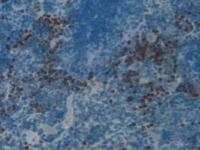 Immunohistochemistry (Formalin/PFA-fixed paraffin-embedded sections) - Anti-PGRPS antibody (AB232728)
