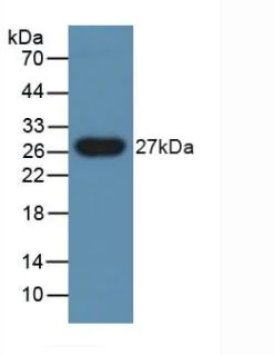 Western blot - Anti-PGRPS antibody (AB232728)