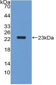 Western blot - Anti-PGRPS antibody (AB232728)